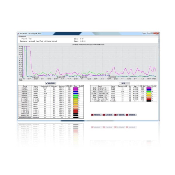 Neurofeedback Performance Software – Bild 14