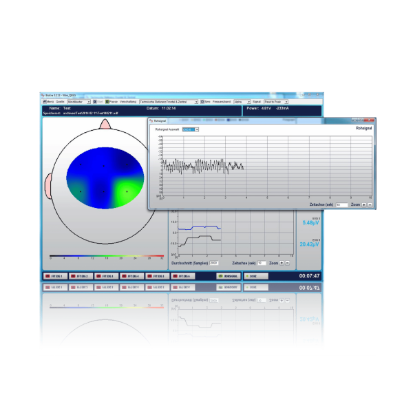 Neurofeedback Software Module: Mini QEEG - Image 3