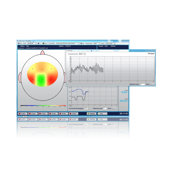 Neurofeedback Software Module: Mini QEEG - Image 2