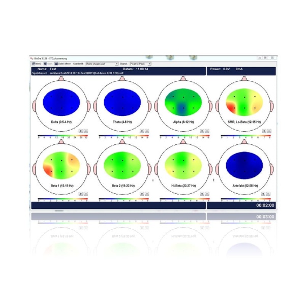 Neurofeedback software module: 6-channel standard situation - Image 2