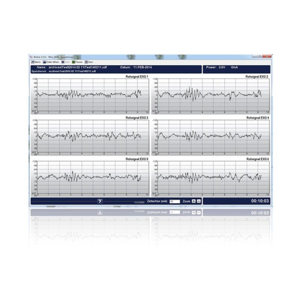 Neurofeedback Software Module: Mini QEEG - Image 4