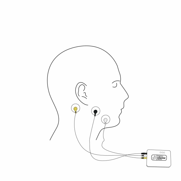 eSense Muscle Pro Edition (2-Channel EMG Biofeedback with Web & Mobile App) - Image 8