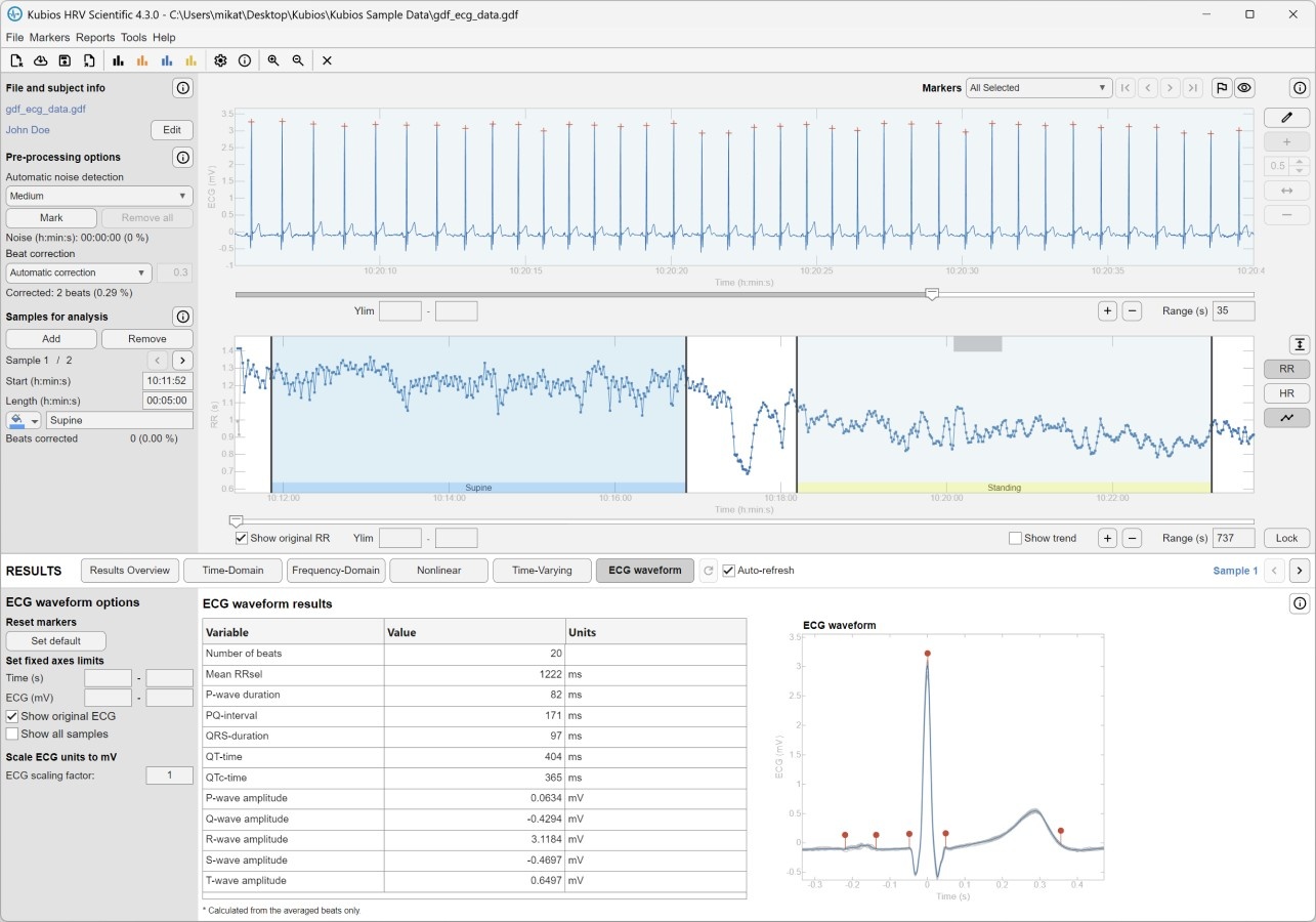 Kubios HRV Scientific: EKG-Wellenform-Analyse