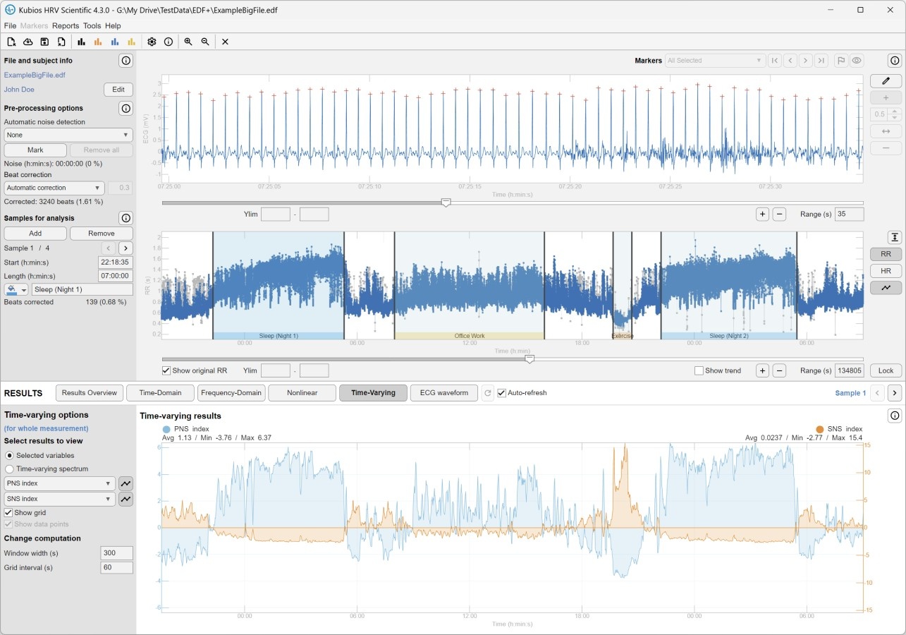 Kubios HRV Scientific: zeitvariable HRV-Analyse