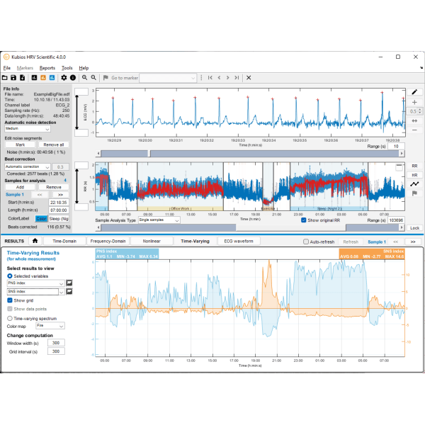 Kubios HRV Scientific Software Lizenz 1-Jahr (Reguläre, kommerzielle Lizenz) – Bild 2