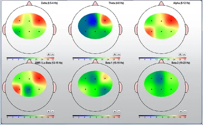 MindMaster Mini-QEEG Brain Maps