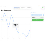 eSense SDK iOS Demo – Hautleitwert (EDA) in Mikrosiemens