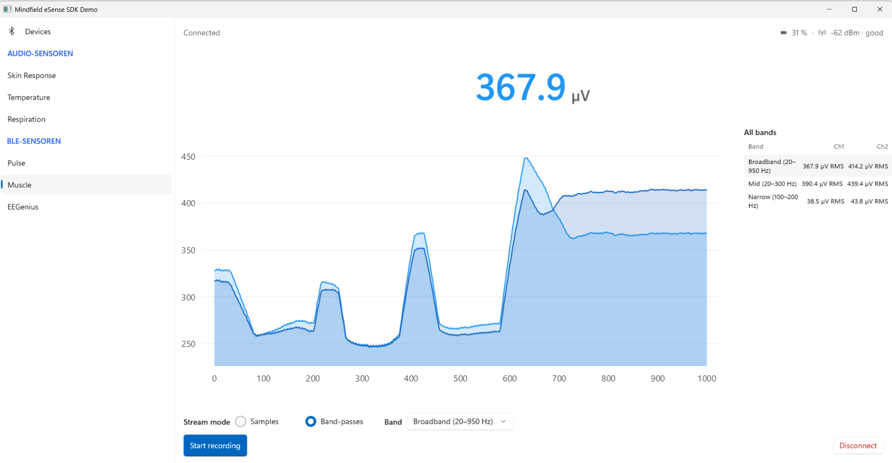 eSense SDK Windows demo – muscle activity EMG in microvolts