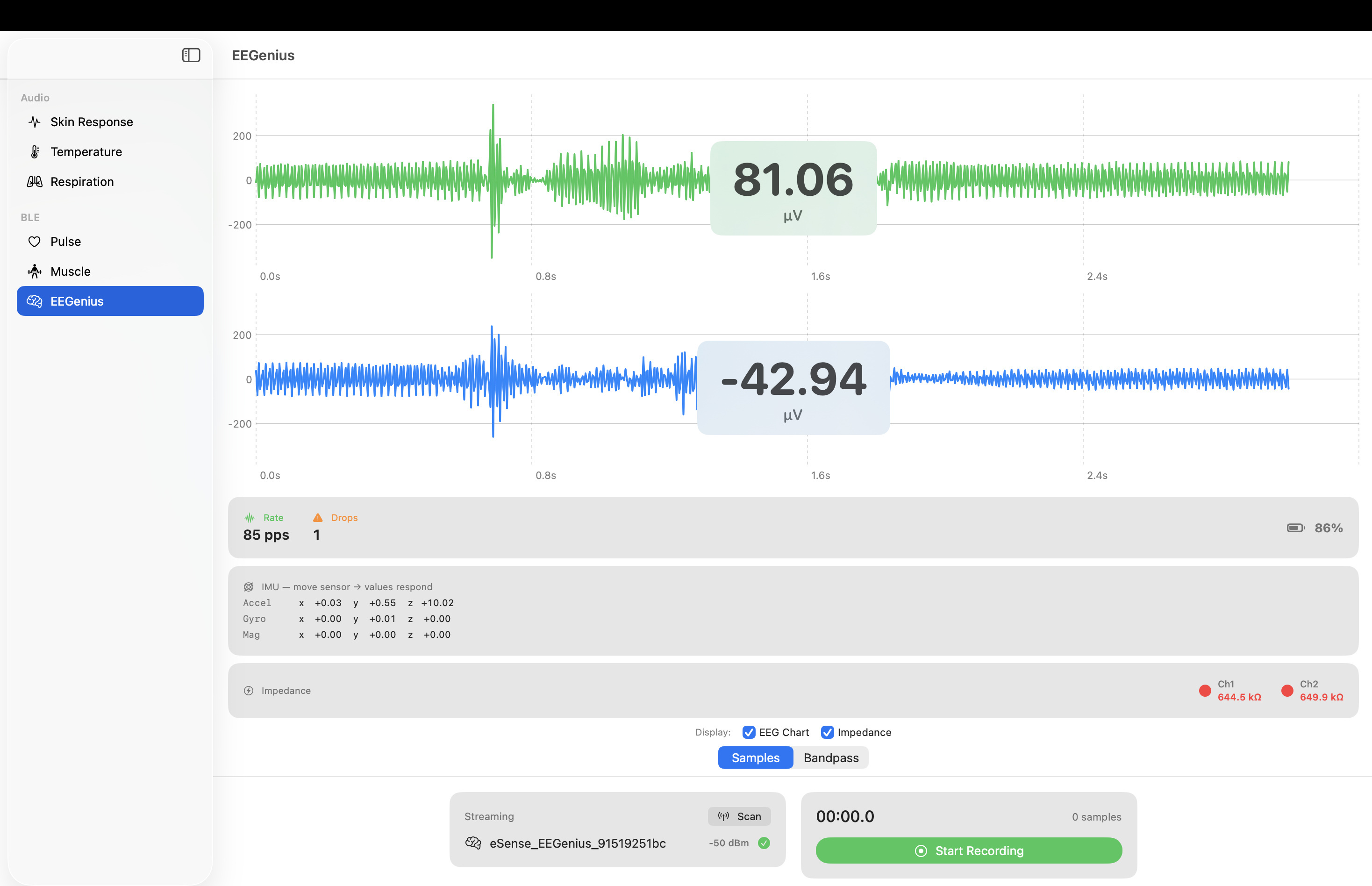 eSense SDK macOS Demo – EEG-Samples (EEGenius, BLE) in Mikrovolt mit Impedanz, 2-Kanal