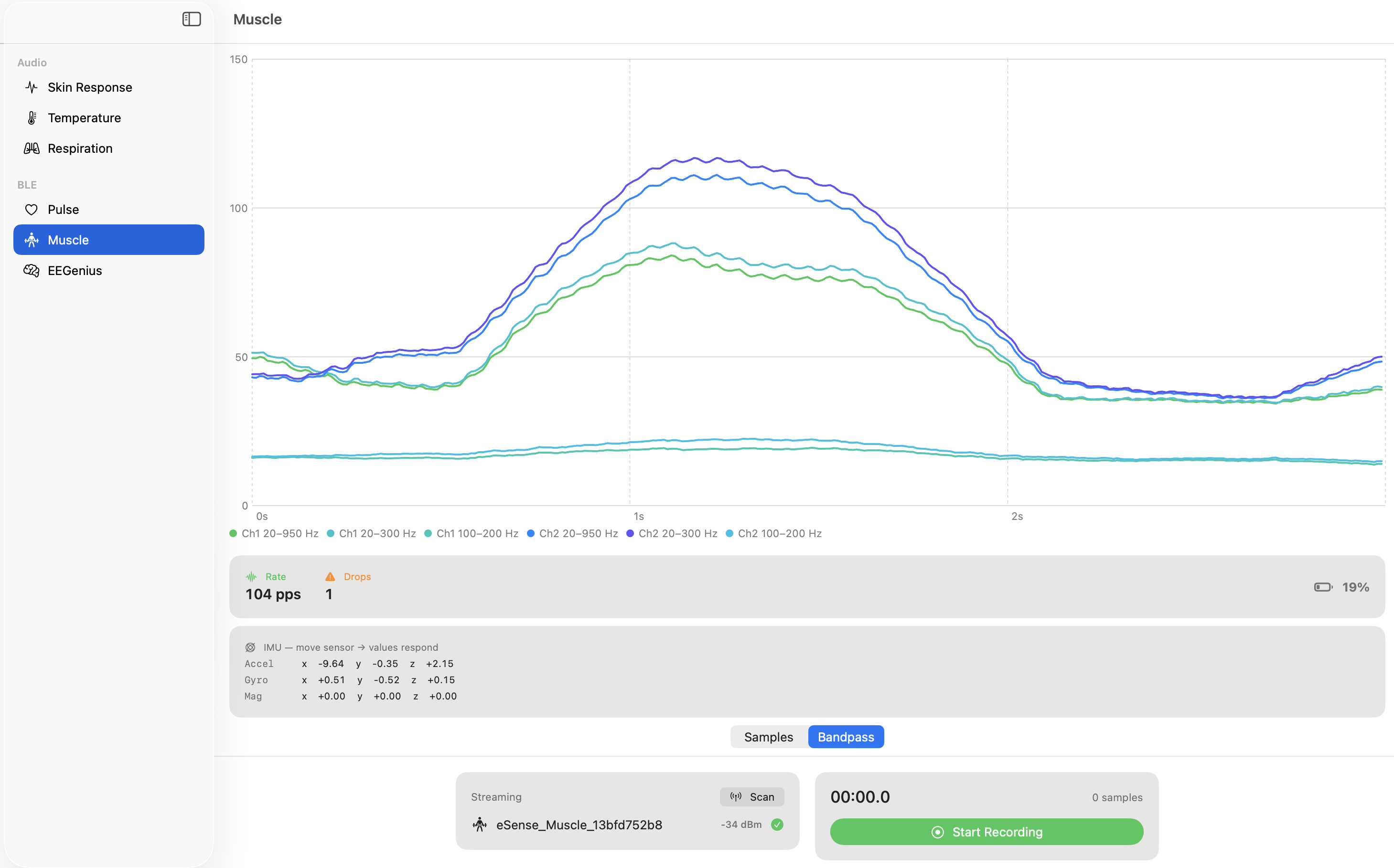 eSense SDK macOS Demo – EMG-Bandpassfilter (Muscle, BLE), 2-Kanal in Mikrovolt